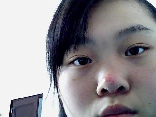 吃瓜后嘴角发红,嘴角红润的秘密解析